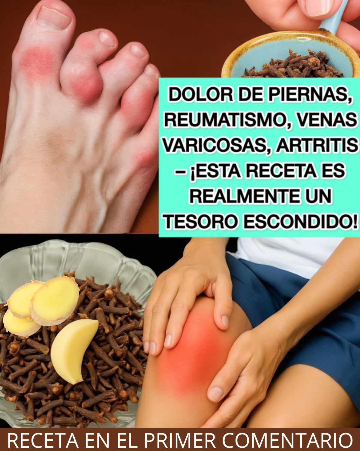 Alivio natural para venas varicosas y articulaciones con jengibre y clavo de olor